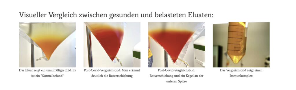 belasteten Eluaten: Inuspherese